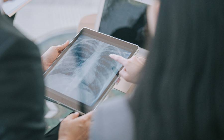 A patient goes over  their lung cancer screening results with their doctor.