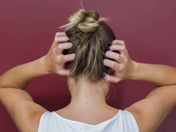 How to Relieve Itchy Scalp -