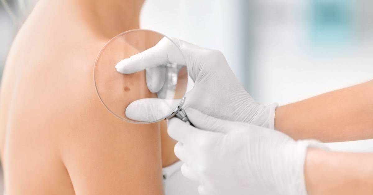 Screening To Save Your Life! How To Find the Best Dermatologist