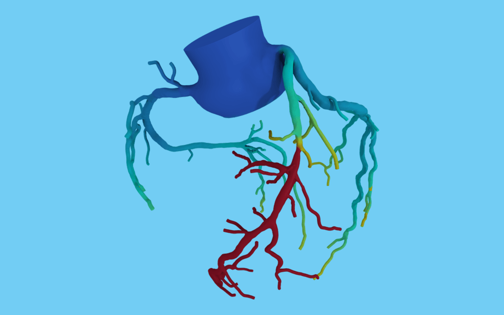 New Way To Diagnose Heart Disease Scripps Health 