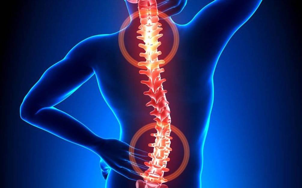 Do I Need Spine Surgery for My Aching Back? (video) - Scripps Health