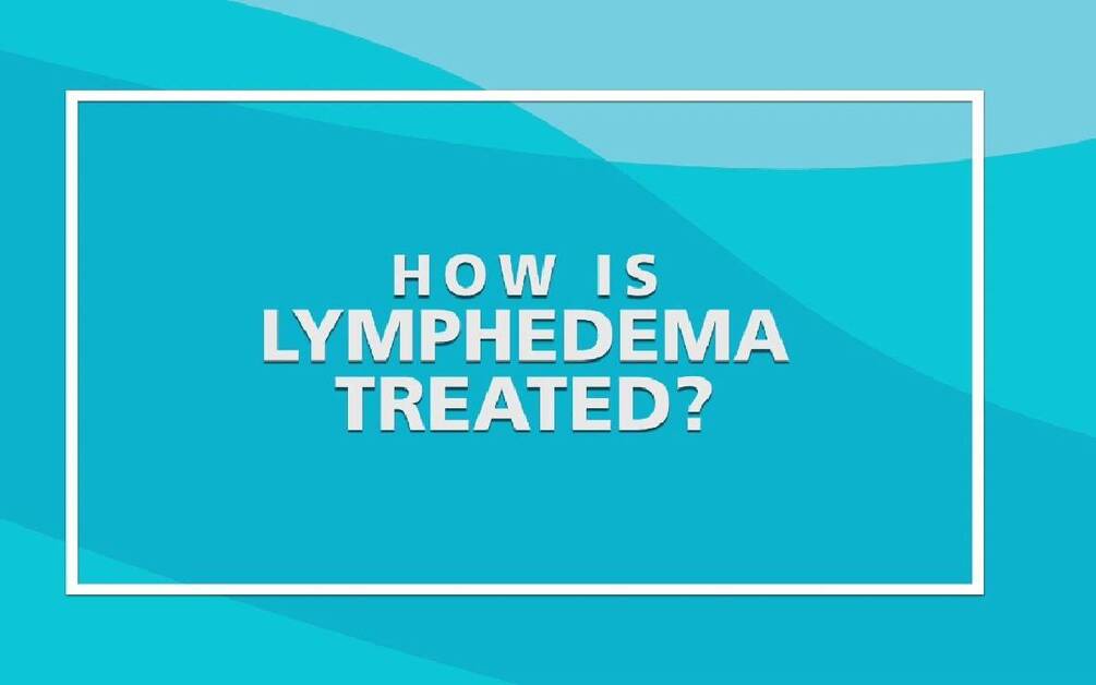 What Is Lymphedema? (video) - Scripps Health